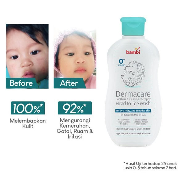 Bambi Baby Dermacare Soothing & Calming Therapy Head To Toe Wash 200ml