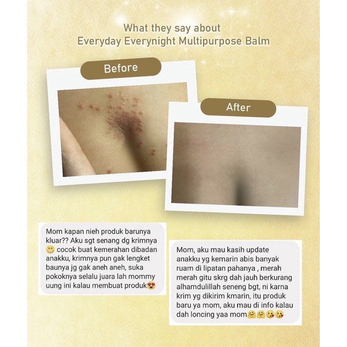 MOELL Multipurpose Balm / Balm Bayi Natural organic / cream iritasi