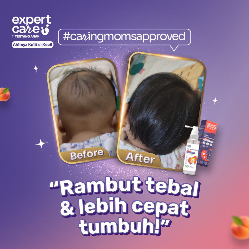 Expert Care - Hair Nutrilotion 100ml - Hair Lotion Rambut Anak & Bayi dengan NUTRIBIOTIC - Kemiri, Keratin, Postbiotic