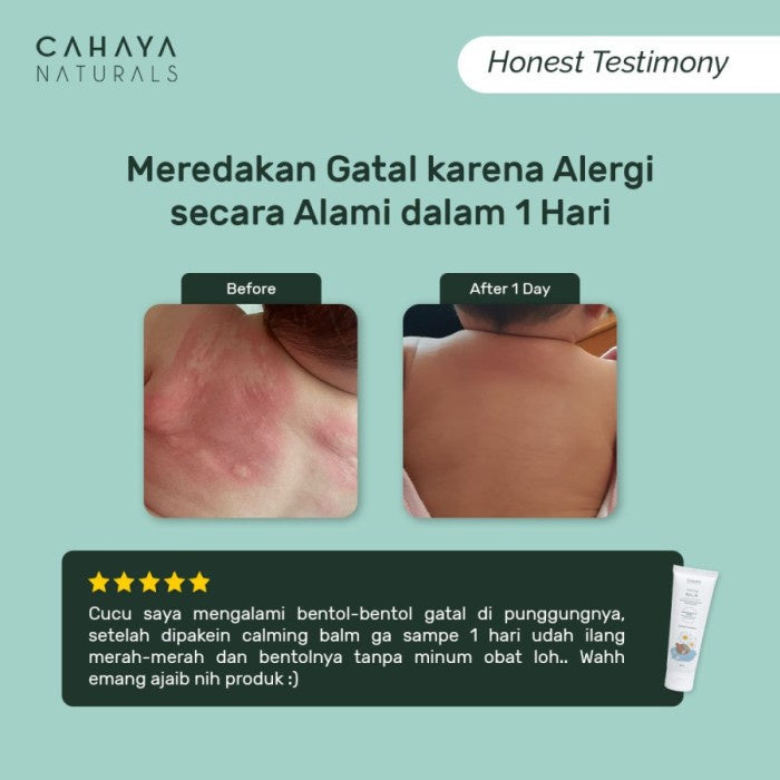 Cahaya Natural Calming Balm (Eczema & Rash Cream) 30 ml / 60 ml
