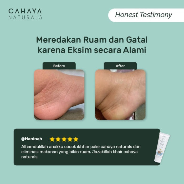Cahaya Natural Calming Balm (Eczema & Rash Cream) 30 ml / 60 ml