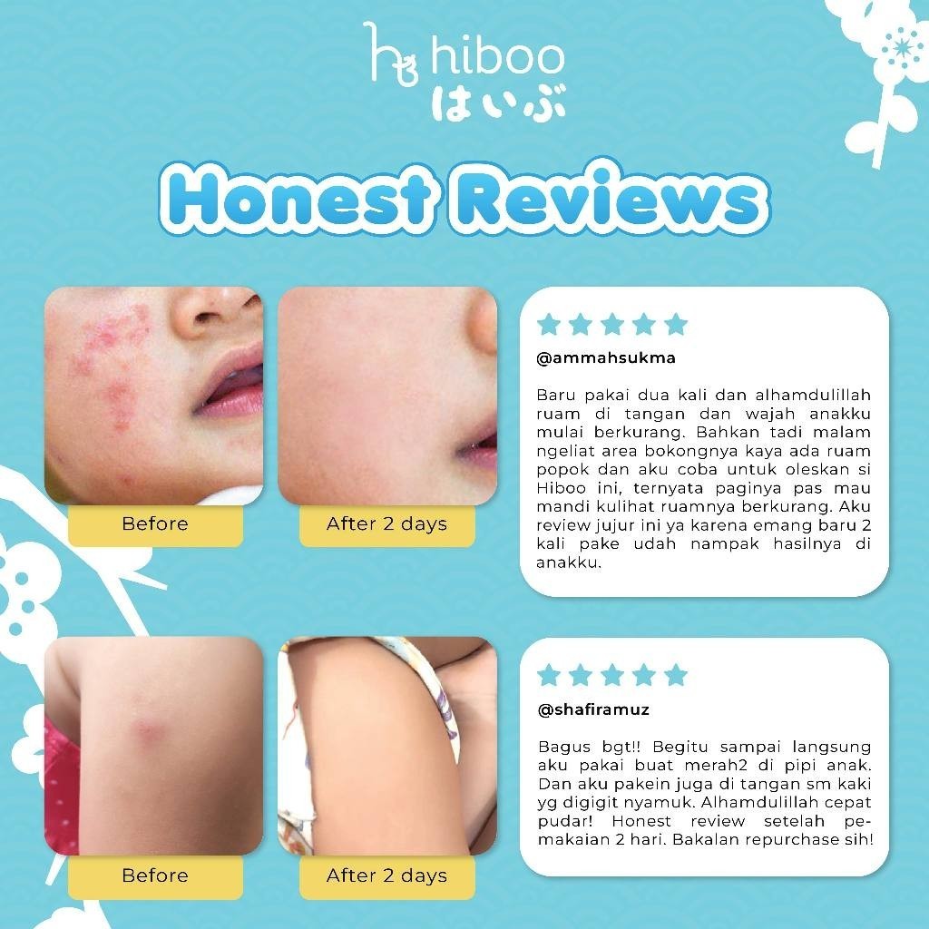 hiboo All Purpose Baby Balm 15g with 10% Coconut Oil Vit E Beeswax - Japan Natural Nourishing Calming Moisturizer - Balsem Salep Anak Bayi Ruam Popok Skincare A11