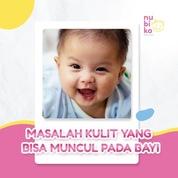 Nubiko Skincare Baby Cream Anak | Spesialis Bekas Luka | Krim Bayi