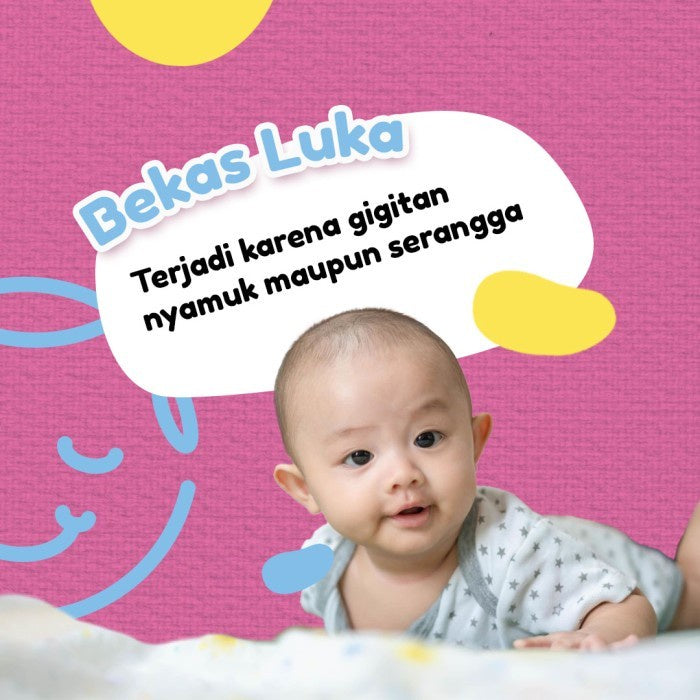 Nubiko Skincare Baby Cream Anak | Spesialis Bekas Luka | Krim Bayi