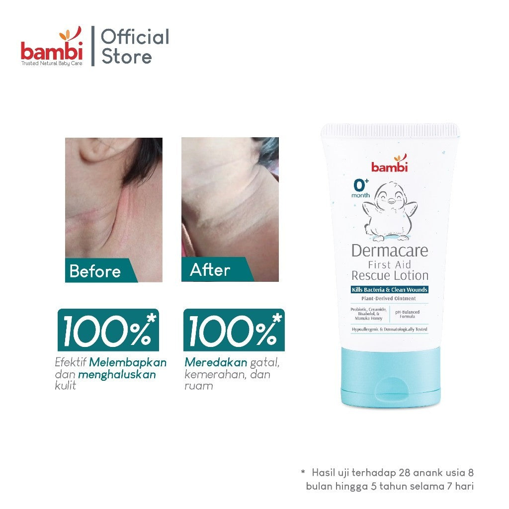 Bambi Baby Dermacare First Aid Rescue Lotion 50ml Anti Luka Antiseptic Anak & Bayi