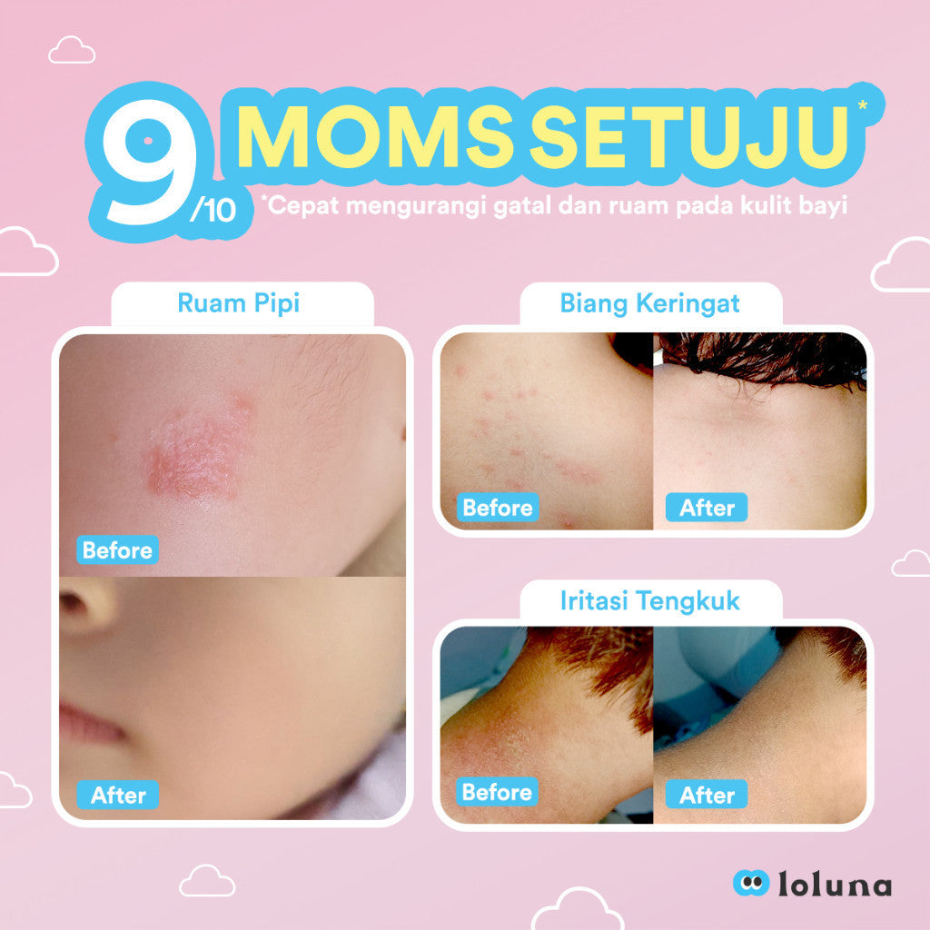 Loluna Cerapair Baby Rash Cream 30ml - Krim anti ruam, iritasi dan gatal gigitan serangga untuk bayi dan anak