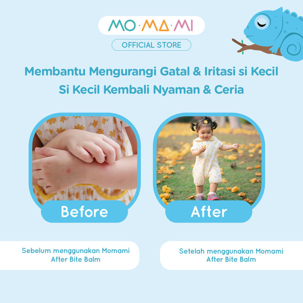 Momami After Bite Balm 14gr – Itch Relief Balsem Pereda Ruam Gatal Gigitan Nyamuk Serangga Anak Bayi