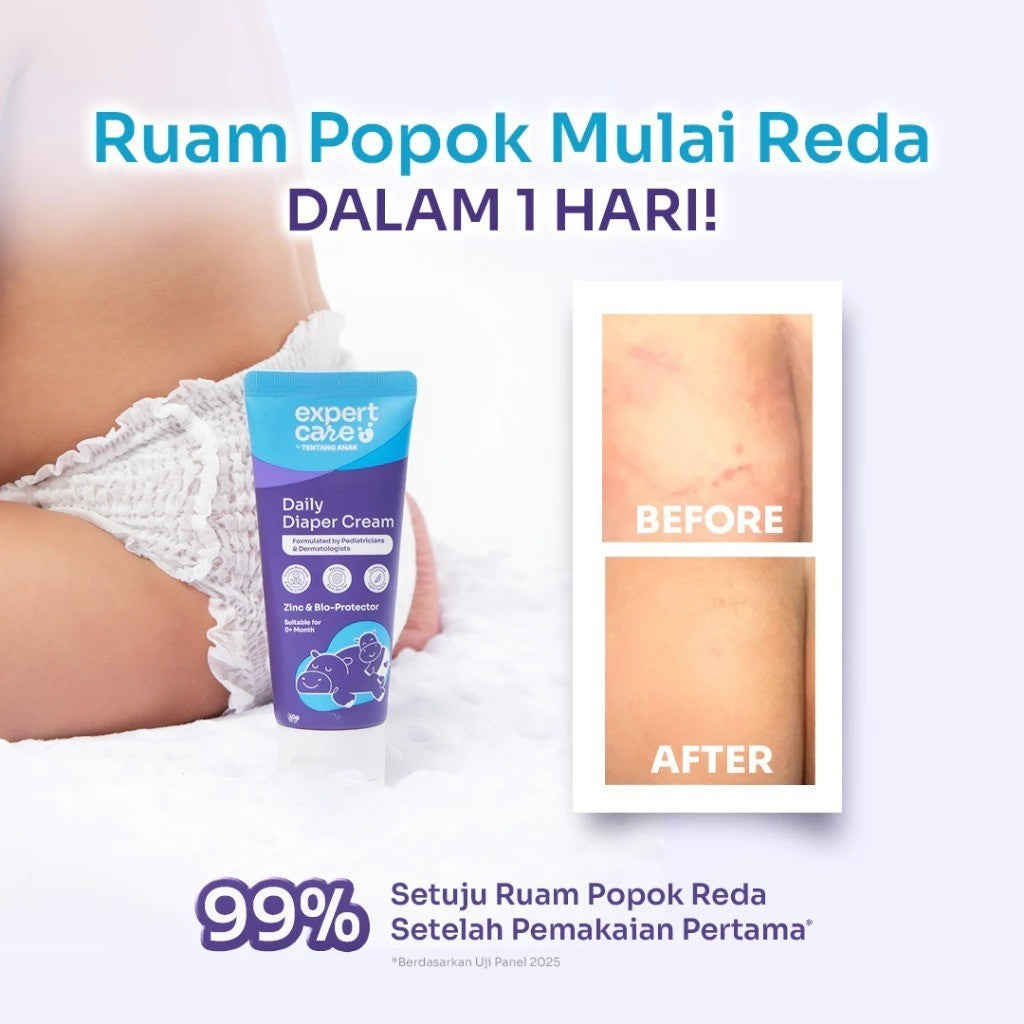 Expert Care Diaper Rash Cream Daily Diaper Cream 40g dengan Zinc Oxide, Panthenol & Bio-Protector - Redakan dan Cegah Ruam Popok - READY MANADO