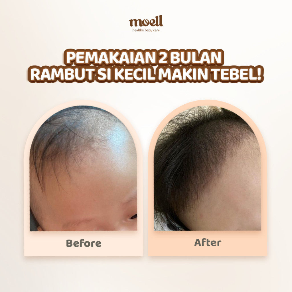 Moell Nourish Hair Everyday / Lotion Baby 100 ml Rambut Lebat Bayi