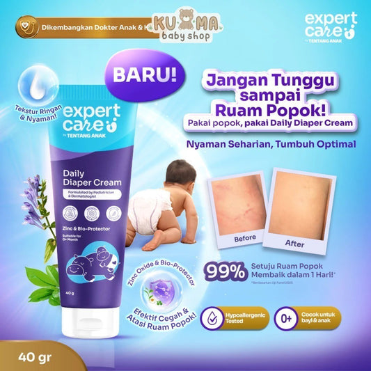 Expert Care Diaper Rash Cream Daily Diaper Cream 40g dengan Zinc Oxide, Panthenol & Bio-Protector - Redakan dan Cegah Ruam Popok - READY MANADO
