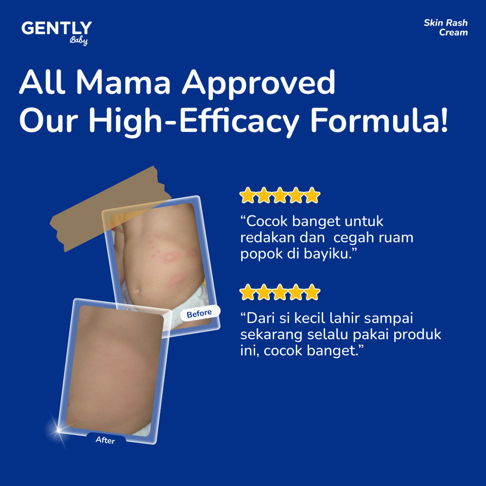 [Tasya Farasya Approved] GENTLY  Baby Rash Cream 20 gr | Krim Pereda Ruam Popok pada Bayi
