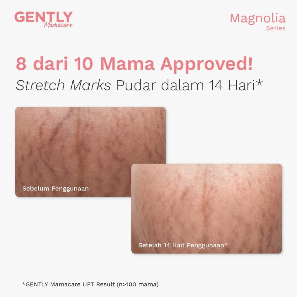 GENTLY Mamacare Advanced Stretch Marks Oil Serum | Arnica Oil + 5x Ceramide + Magnolia Extract + 3% Niacinamide Snow Crocus Extract + Vegan Collagen | Skincare Ibu Hamil dan Menyusui Terdaftar BPOM | Oil Serum untuk Menyamarkan Peregangan Kulit