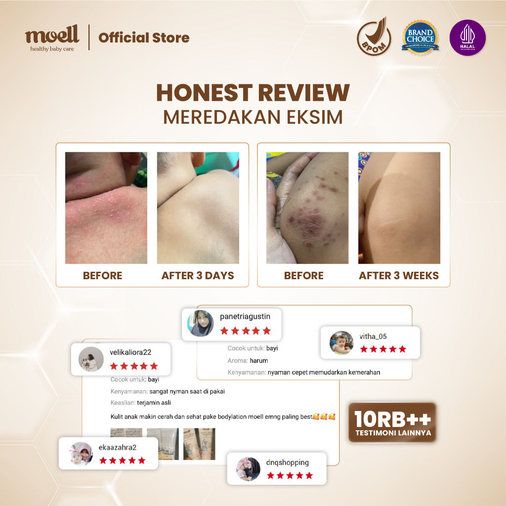 Moell Body Lotion Bayi Travel Size 80gr - Melembapkan Kulit Badan Anak - Perawatan Kulit Kering dan Sensitif - Pelembap Bayi Anak Daily Use - Sensitif Kering Ruam - Skincare Bayi Formulasi Dokter dengan Microbiome Teknologi - Skincare Anak