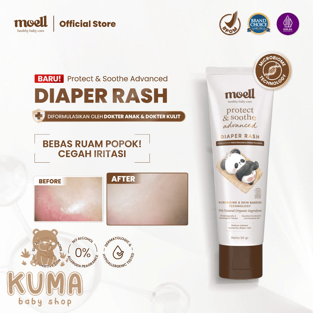 [BARU!] Moell Diaper Rash Advanced 50gr - Krim Popok Redakan dan Cegah Ruam Popok - Bebas Ruam Nyaman Seharian - Organic Calendula oil, Zinc Oxide, Postbiotic
