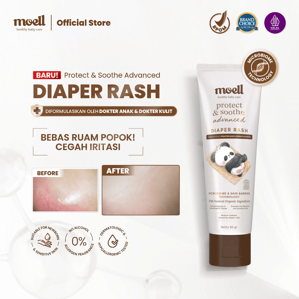 [BARU!] Moell Diaper Rash Advanced 50gr - Krim Popok Redakan dan Cegah Ruam Popok - Bebas Ruam Nyaman Seharian - Organic Calendula oil, Zinc Oxide, Postbiotic